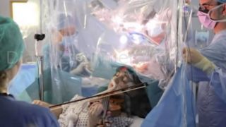 Paciente Toca El Violín Durante Su Propia Cirugía Cerebral Para Preservar Su Motricidad Fina